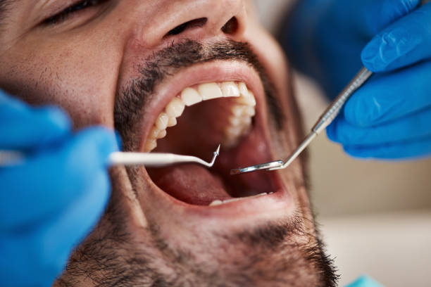 Best Knocked-Out Tooth Emergency  in Hemet, CA